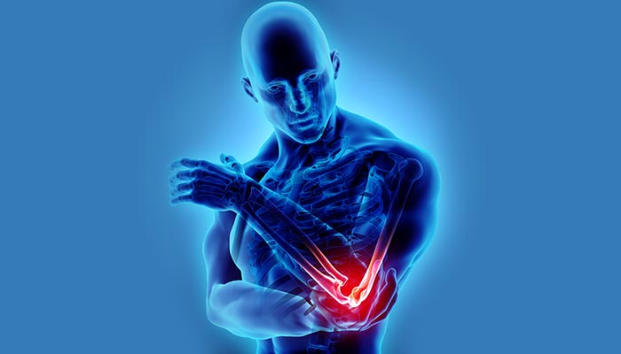 What is Tennis Elbow? Common Side Effects and Treatments