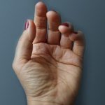 7 Common Hand Surgery Recovery Mistakes to Avoid