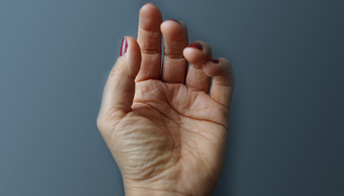 7 Common Hand Surgery Recovery Mistakes to Avoid