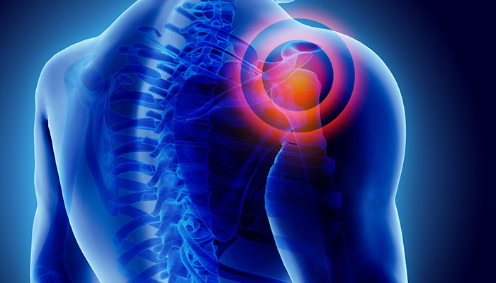 Use These Exercises to Ease Shoulder Pain and Stress