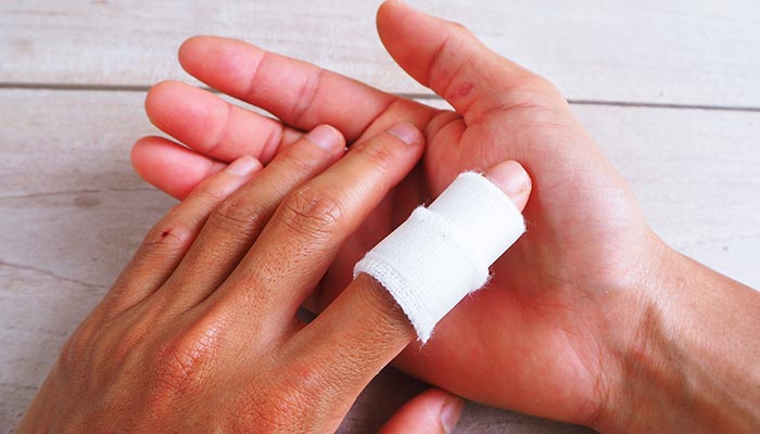 Your Finger Injury Guide: What They Are and How to Treat Them