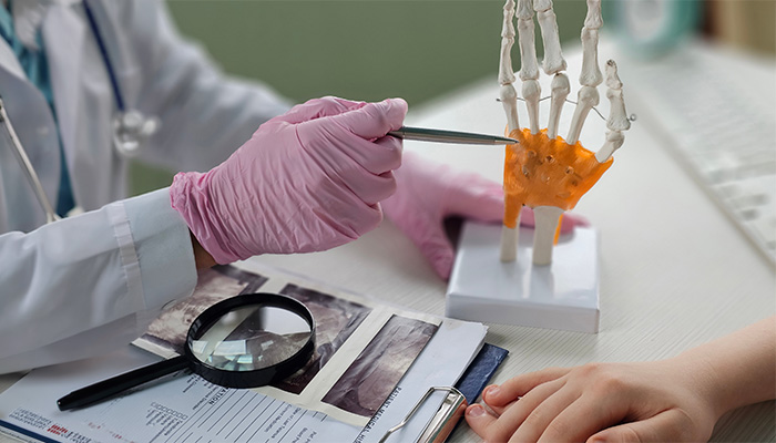 Your Hands Deserve Care: Early Signs of Carpal Tunnel Syndrome